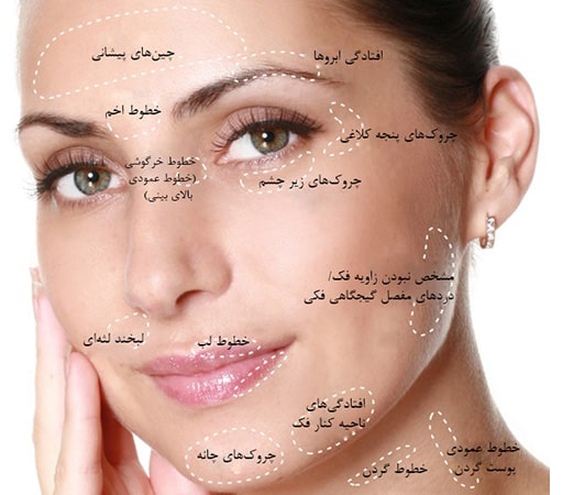 عوامل شایع بروز خط اخم