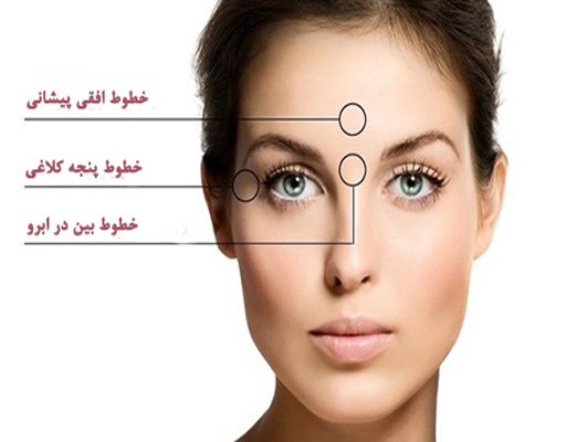 قیمت تزریق ژل خط اخم