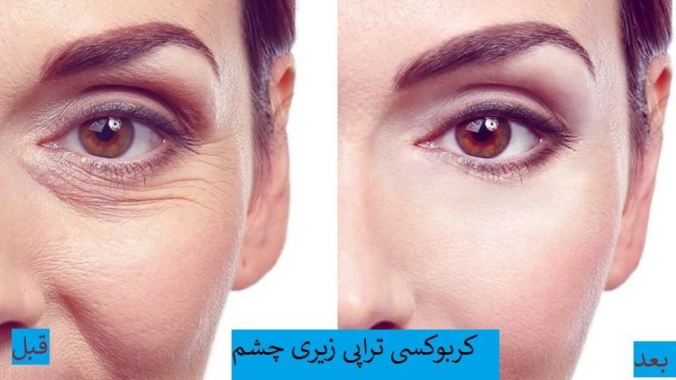 تولید این گاز به صورتی عادی و طبیعی نیز در بدن افراد رخ می دهد