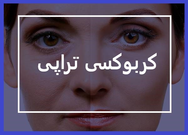 گلوکز می تواند در حضور اکسیژن شروع به سوختن نماید