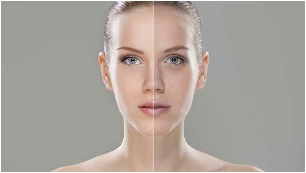 داشتن یک پوست صاف و بدون چروک به ما احساس زیبایی و جوانی می دهد