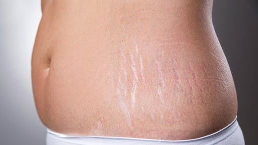 یک پزشک اطراف اسکار را تمیز می کند