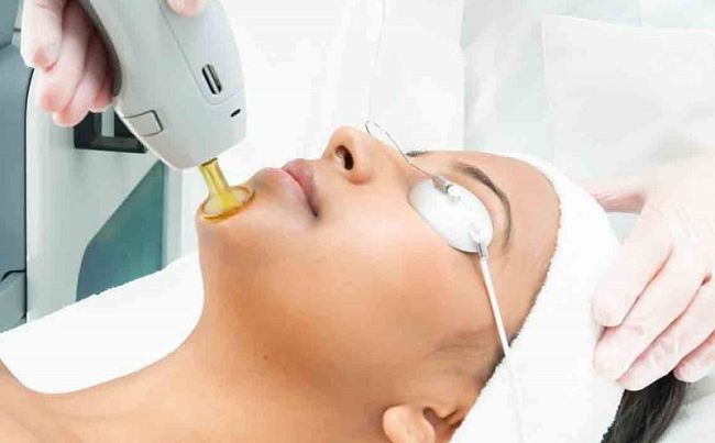 مراقبت بعد از لیزر الکساندرایت