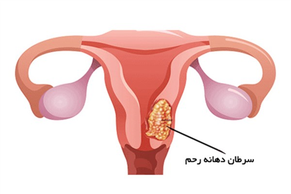 رحم به جهت فضای خاصی که دارد، دارای سلول های بسیاری می باشد