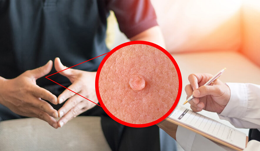 چه افرادی نیاز به انجام تست پاپ اسمیر ندارند؟
