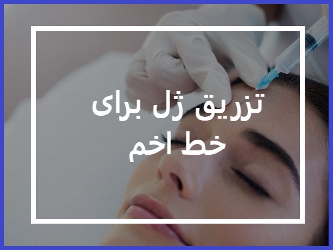 تزریق ژل اخم ابرو