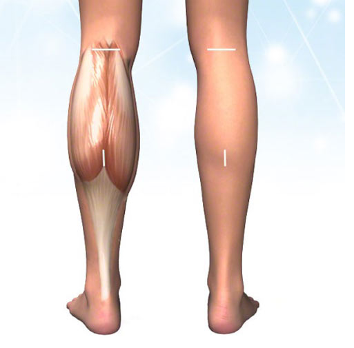 استرس