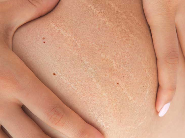 کربوکسی تراپی در درمان های زیبایی و جوانسازی پوست