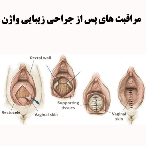 ناحیه تناسلی در زندگی هر فرد بسیار مهم است