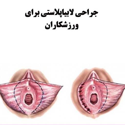 افزایش سن: