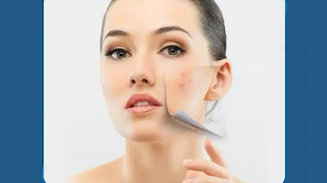 جای جوش بر روی پوست