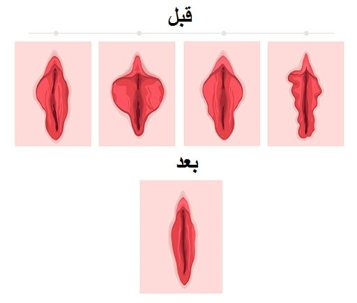 تغییرات ژنتیکی: