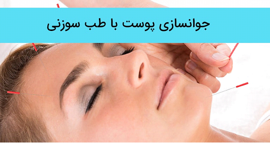 چه عامل هایی بر تعیین قیمت امبدینگ صورت تاثیر می گذارند؟