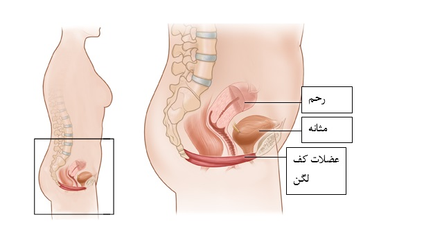 از یک پزشک معالجی که تخصص کافی را در زمینه بالا کشیدن رحم دارد، استفاده کنید