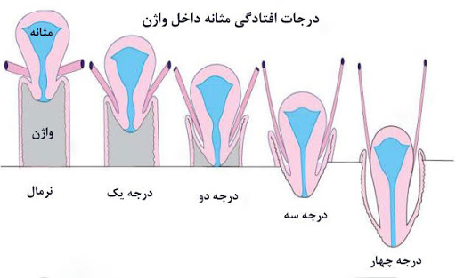 مصرف مرتب داروها و کپسول ‌هایی که پزشک برای شما تجویز کرده ‌است