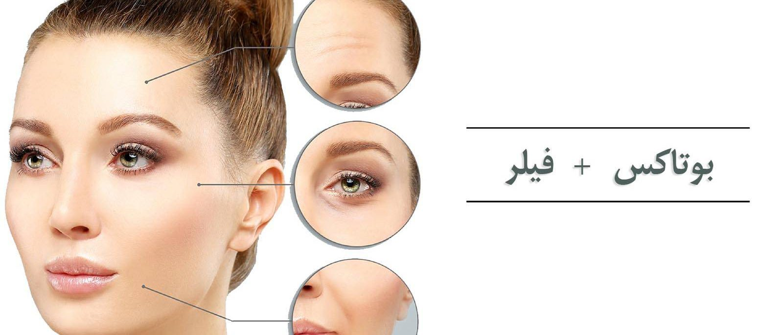 این نخ ها به کمک سوزن های مخصوص انجام طب سوزنی وارد می شود
