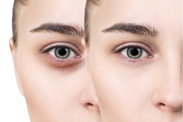رگ های پهن به معنای خون رسانی بیشتر است