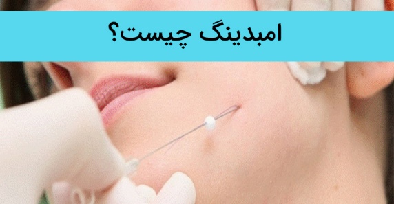 عبارت امبدینگ صورت به چه مفهوم است و به انجام چه کاری اطلاق می شود؟