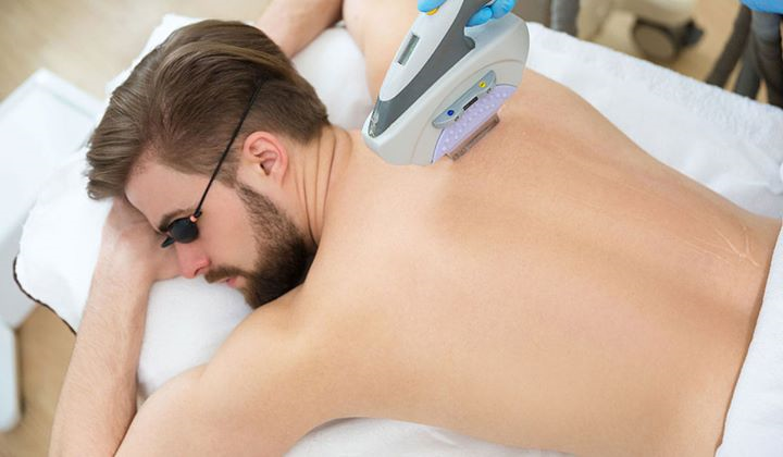 آیا موهای نازک و کرکی را می توان لیزر کرد؟ آیا لیزر موهای کرکی صورت موثر است؟