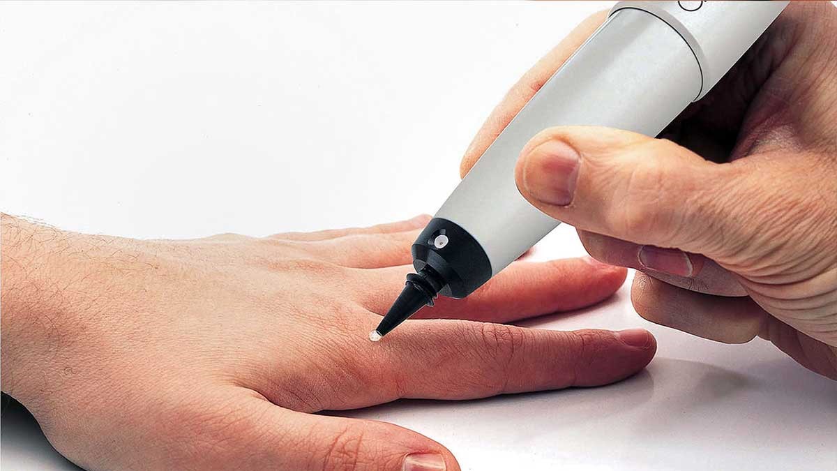 حذف چربی های انباشته در نواحی مختلف بدن