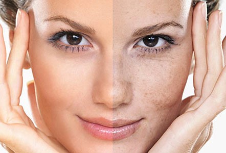 عملکرد لیزر در دستگاه لیزر اسکلپیون