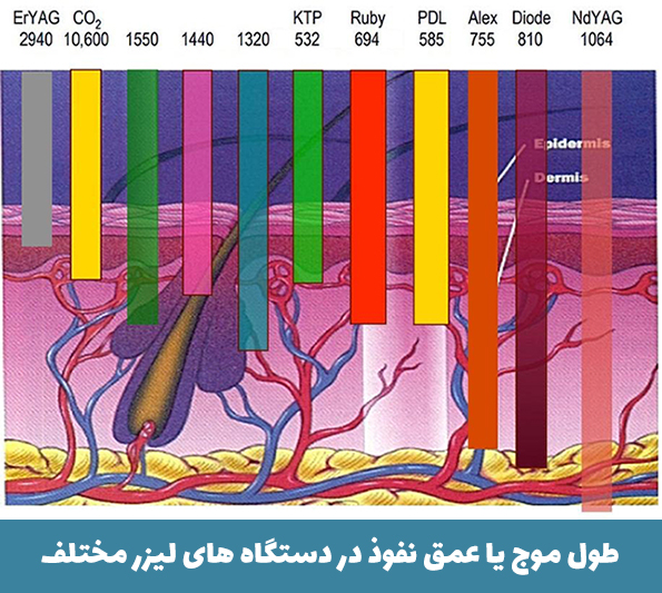 طول موج لیزر الکساندرایت
