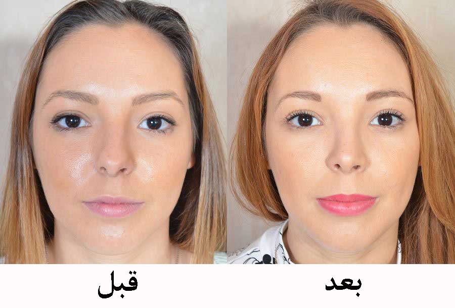 آیا در زمینه ی زاویه دار کردن صورت اطلاعاتی دارید؟