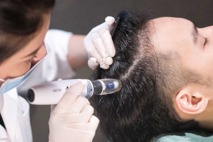 مزوتراپی چیست و آیا مزوتراپی باعث رویش مجدد موها می شود ؟