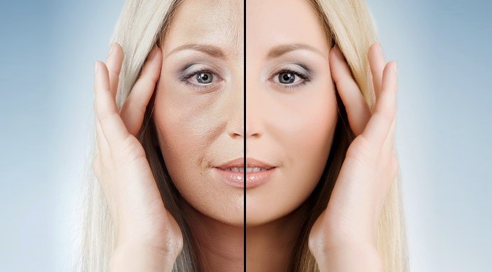 مزایای استفاده از میکرونیدلینگ