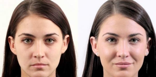 با هایفوتراپی، چین و چروک های صورت از بین می رود
