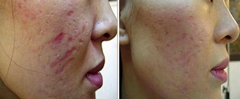 پزشک متخصص می تواند تعداد شیوه های درمانی و نحوه ی انجام هر کدام از آن ها را تعیین نماید