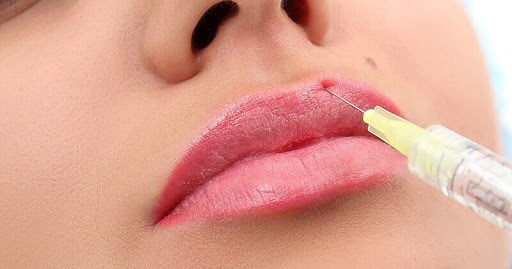 مراقبت های قبل از تزریق ژل به لب چیست؟