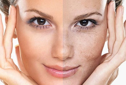 آیا در زمینه ی مهم ترین کاربردهای مربوط به شیوه ی میکرونیدلینگ اطلاعاتی دارید؟