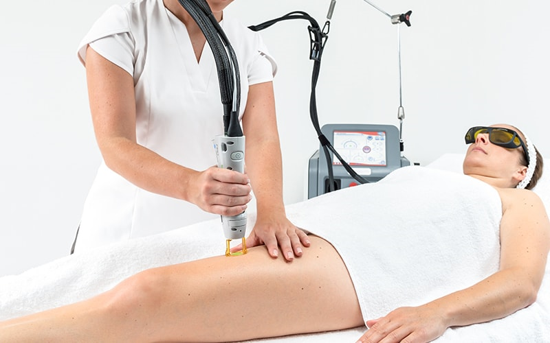 آیا لیزر بیکینی باعث ناباروری خواهد شد؟