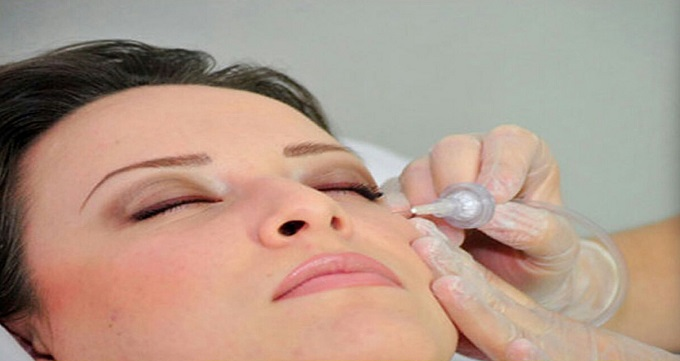 کربوکسی تراپی از چه چیزی تشکیل شده است؟