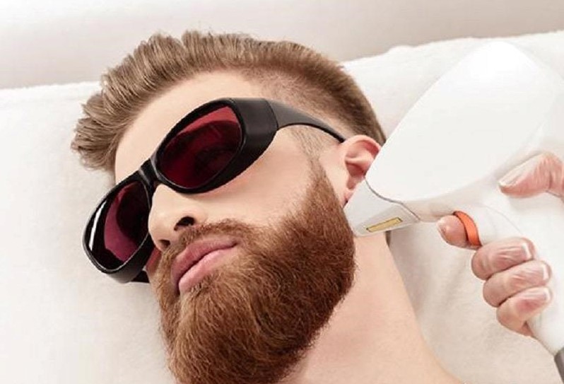 شیوه انجام لیزر خط ریش به چه صورتی می باشد؟