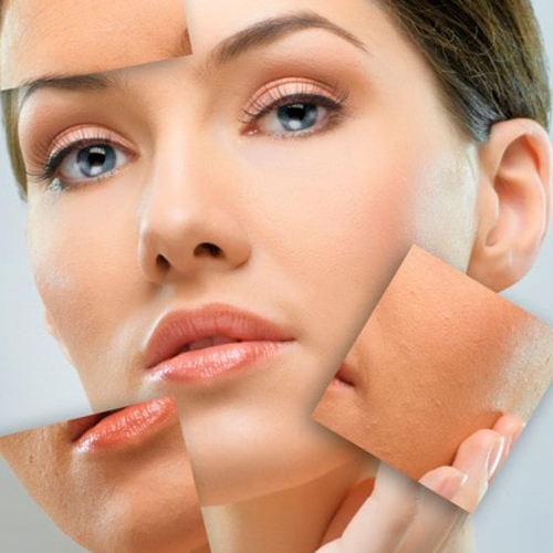 روش درمانی کربوکسی تراپی چگونه انجام می شود؟