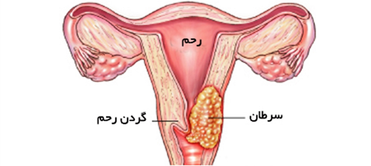ویتامین C