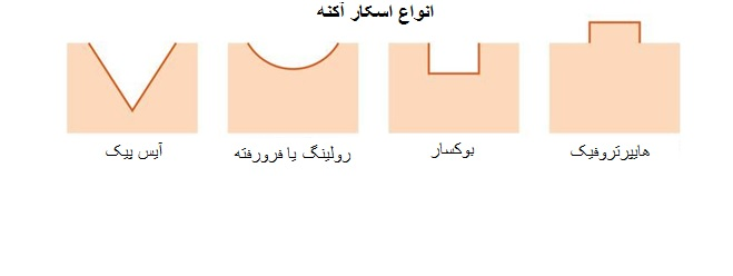 درمان کدام اسکار با لیزر امکانپذیر میباشد؟