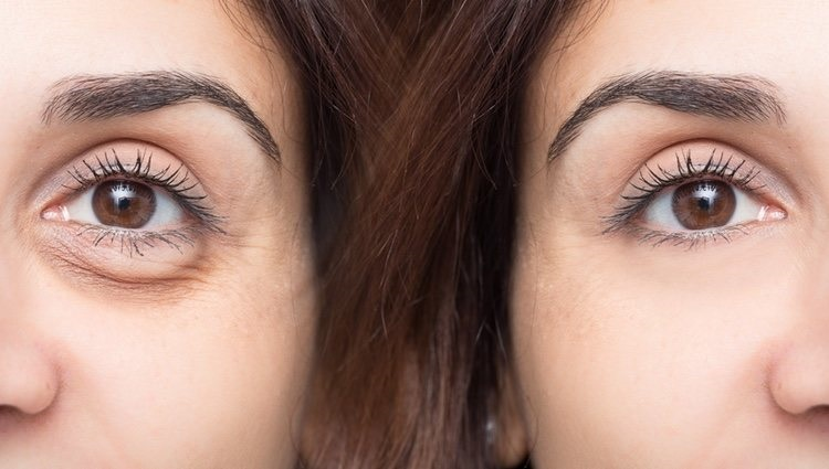 کاربردهای کربوکسی تراپی