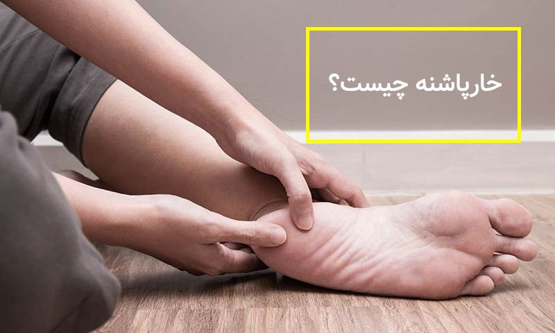 چگونگی تشخیص خار پاشنه