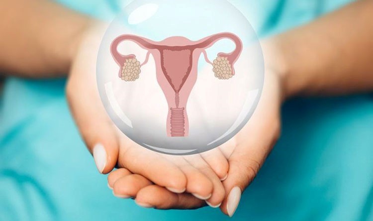 تنبلی تخمدان (Polycystic Ovary Syndrome) چیست؟