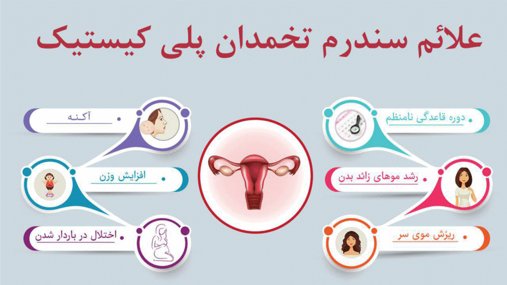 نشانه های تنبلی تخمدان