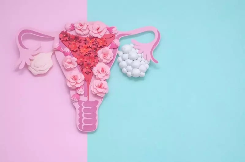 نشانه های PCOS در مراحل پیشرفته