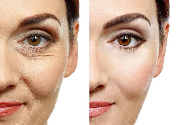 تاریخچه کربوکسی تراپی به چه صورت است؟