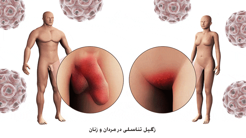 سرطان آلت تناسلی مردان
