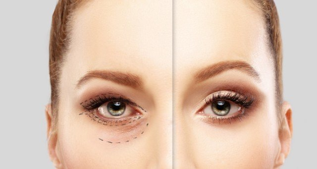 نواحی زیر چشم از اهمیت بالایی برخوردار میباشند