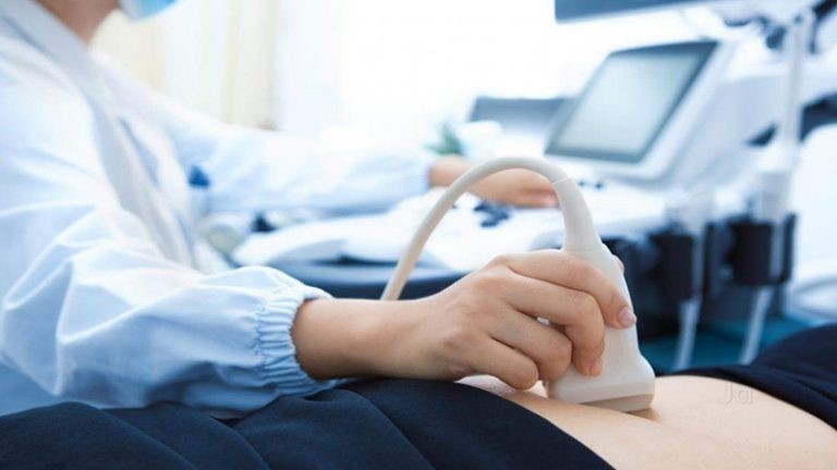 آیا تنبلی تخمدان می تواند باعث چاقی در افراد شود؟