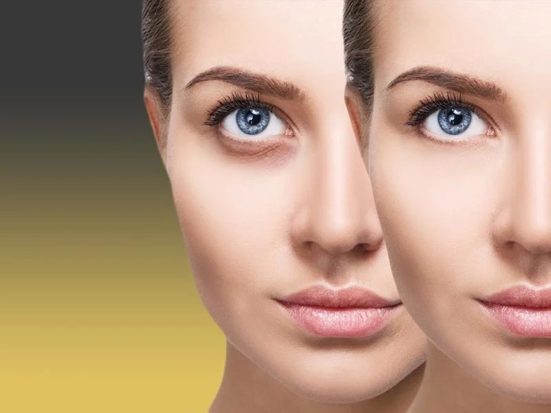 دستگاه کربوکسی تراپی به یک کپسول حاوی گاز دی اکسید کربن متصل است