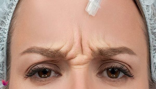 تزریق ژل خط اخم